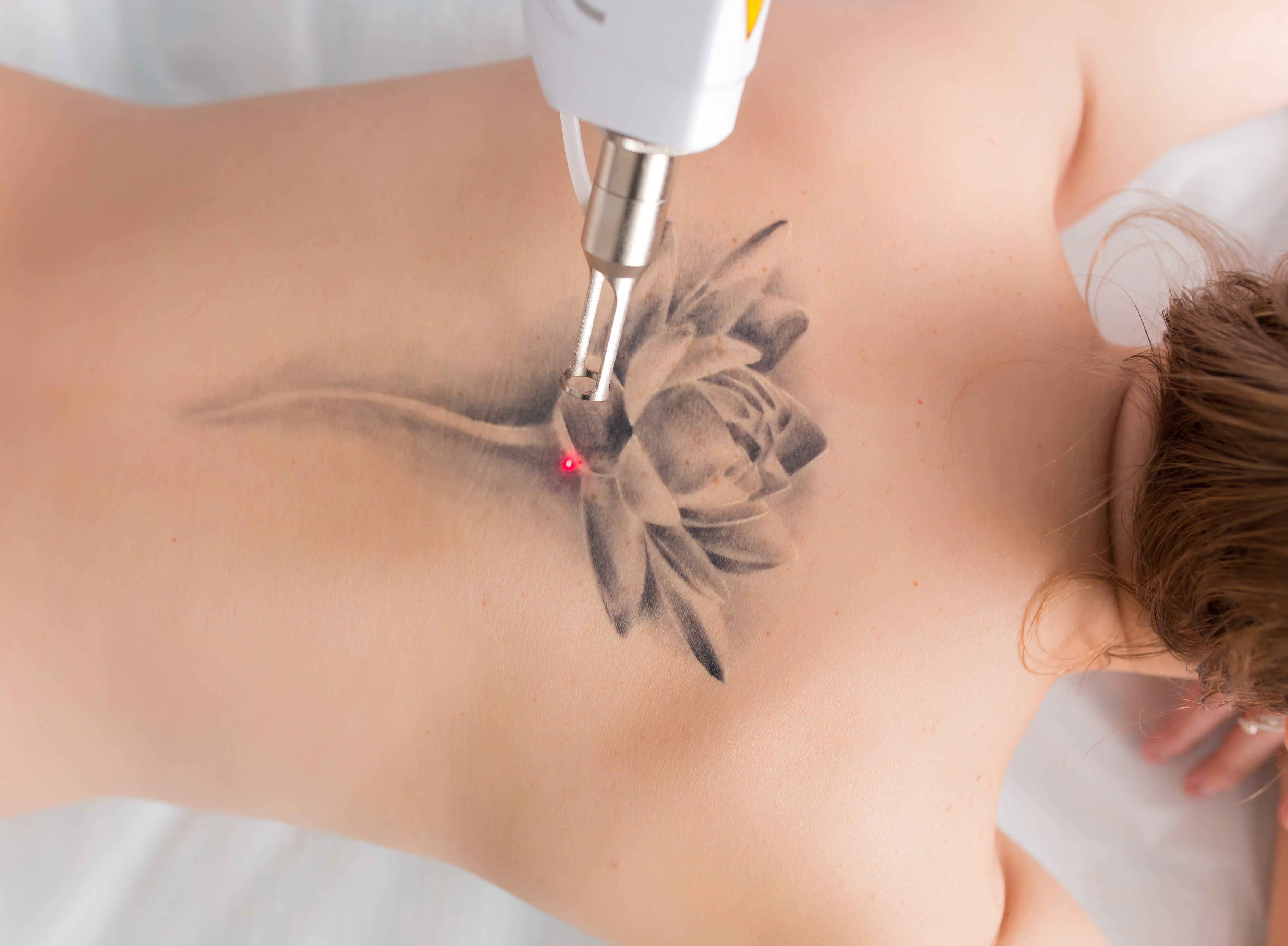 Dermatologie Gent